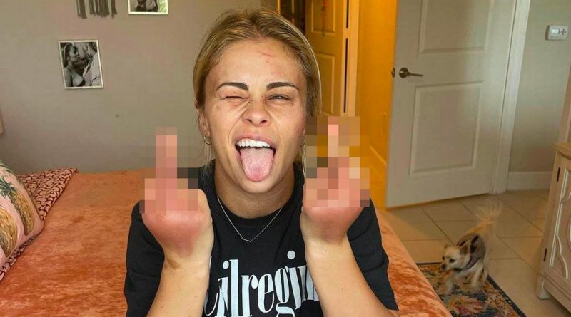 Paige VanZant shows off face and hand injuries after bare-knuckle defeat