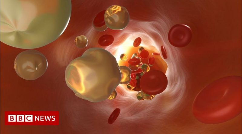 Life-saving cholesterol jab recommended on NHS