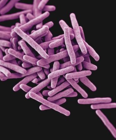 Africa’s laboratories need to step up testing to aid in fighting Anti-Microbial Resistance. This photo is a 3D computer-generated image of Mycobacterium tuberculosis bacteria, the pathogen responsible for causing the disease tuberculosis (TB). Credit: CDC/Unsplash